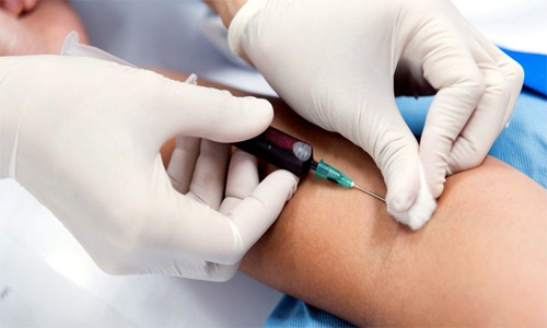Vitamina C endovenosa